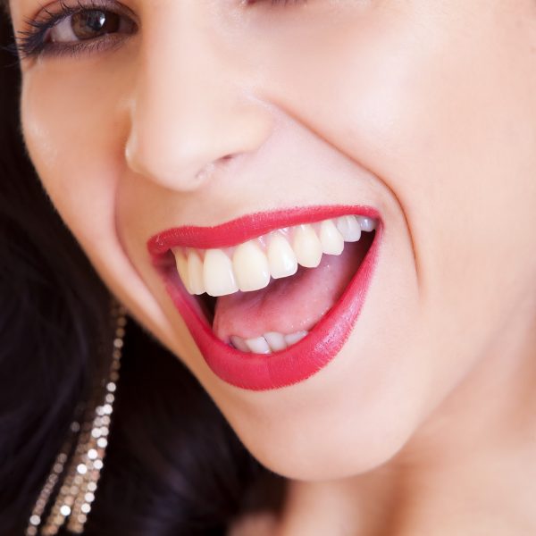 The Dangers of Teeth Whitening